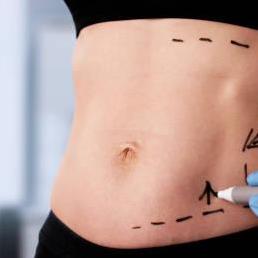 Liposuction  In Riyadh